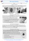 Health ED -  - Activity Lesson: Skin Cancer Screening