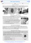 Health ED -  - Activity Lesson: Skin Cancer Screening