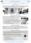 Skin Cancer Screening